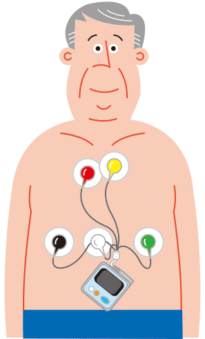 ホルター心電図